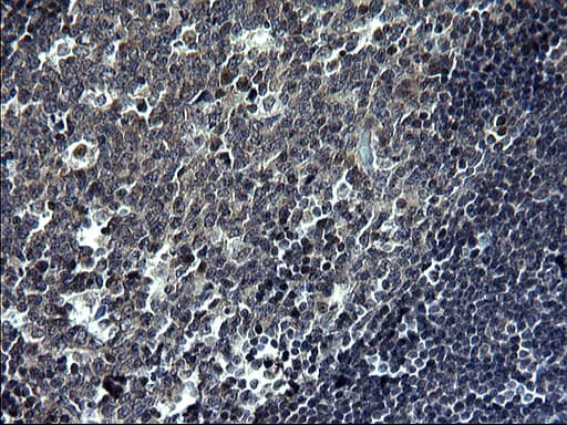 TNF Alpha Antibody (clone OTI1D9)