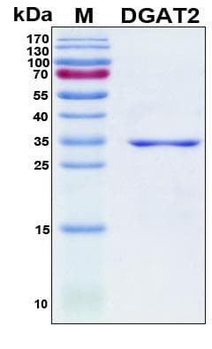 Human DGAT2 Protein (Recombinant His, N-Terminal)