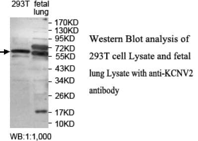 KCNV2 / Kv11.1 Antibody (aa12-154)