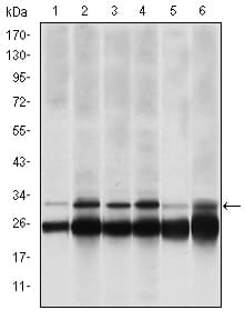 PSMB8 / LMP7 Antibody (clone 1A5)
