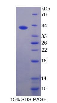 Human FUT6 Protein (Recombinant His-T7)