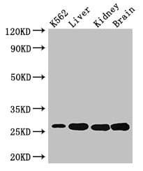 Polyclonal Rabbit anti-Human QDPR / DHPR Antibody