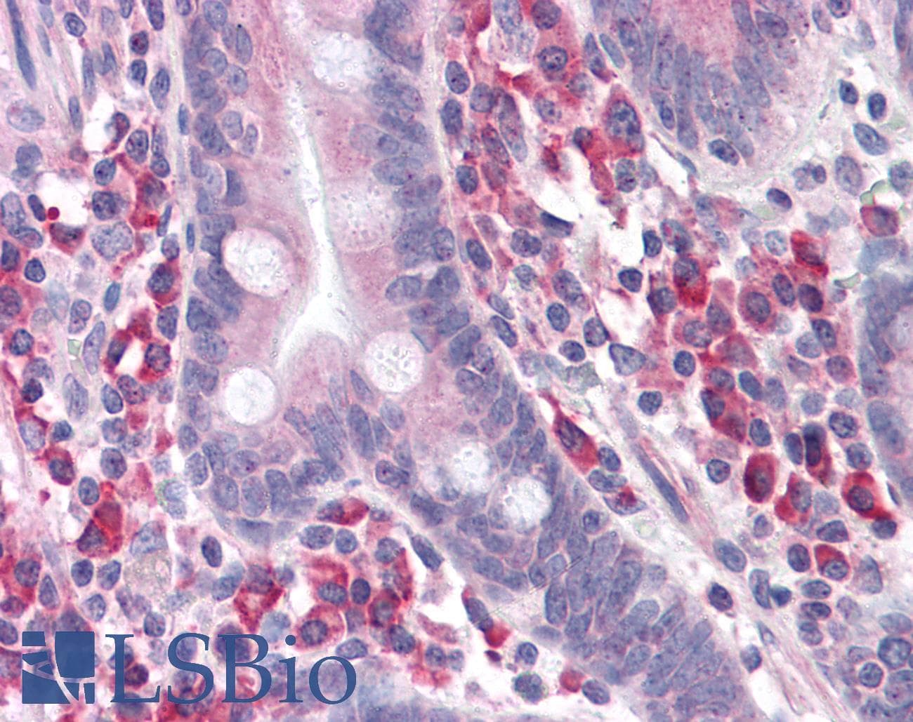 IHC-plus™ ANKRD27 Antibody