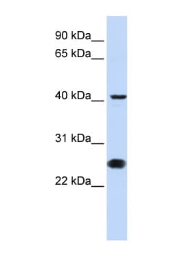 Polyclonal Rabbit anti-Human CDC25C Antibody (N-Terminus, WB)