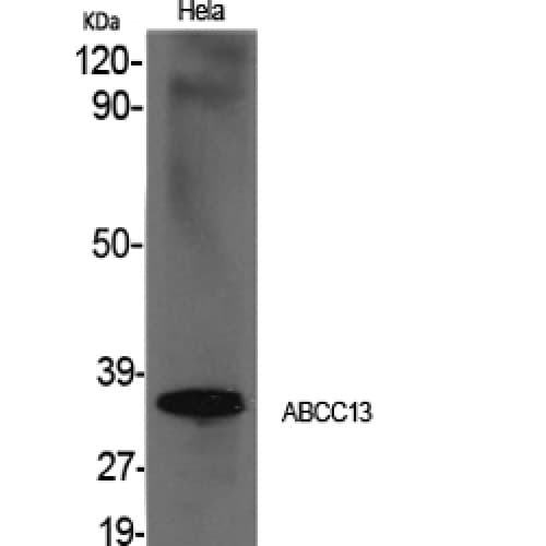 ABCC13 Antibody (30-110 aa, Internal)
