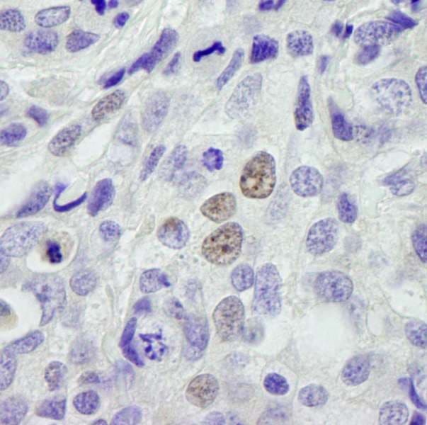 CPSF3L Antibody (aa550-600)