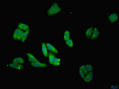 Polyclonal Rabbit anti-Human MRPL28 Antibody (aa1-256, IHC, WB)