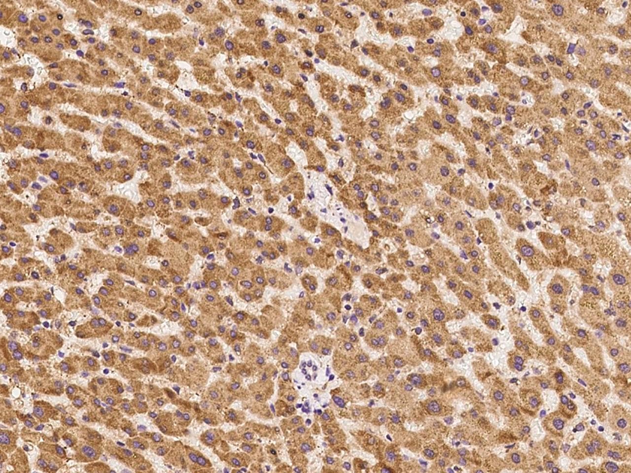 Polyclonal Rabbit anti-Mouse HSPA5 / GRP78 / BiP Antibody (IHC, WB)