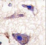 Polyclonal Rabbit anti-Human NPTX1 Antibody (aa364-393, IHC, WB)