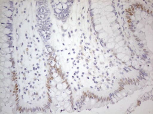 CDKN1A / WAF1 / p21 Antibody (aa2-164, clone OTI7C8)