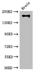 ITGB4 / Integrin Beta 4 Antibody