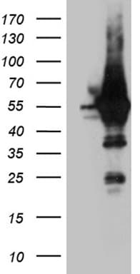 Monoclonal Mouse anti-Human ARC / Arg3.1 Antibody (clone OTI2B3, aa100-396, WB)