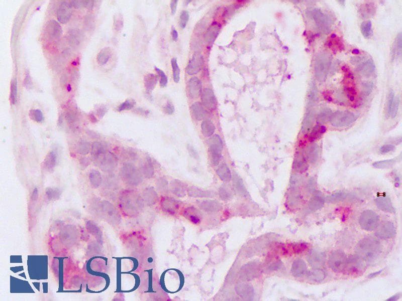 IHC-plus™ HUNK / B19 Antibody (Internal)