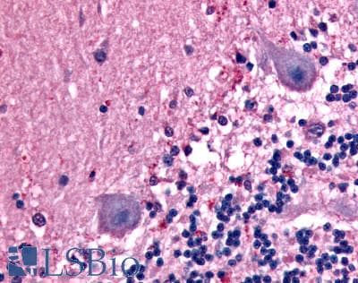 IHC-plus™ Polyclonal Rabbit anti-Human ADGRB1 / BAI1 Antibody (C-Terminus, IHC)