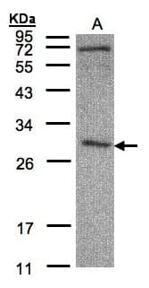 Polyclonal Rabbit anti-Human CLIC3 Antibody (aa1-236, IHC, WB)