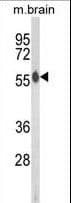 AKT2 Antibody