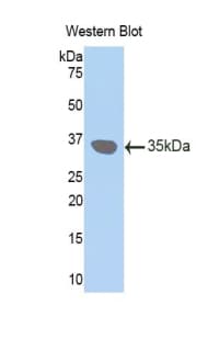 GJB3 / CX31 / Connexin 31 Antibody (aa210-270)