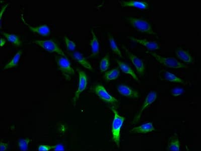 Polyclonal Rabbit anti-Human SLC25A46 Antibody (WB)