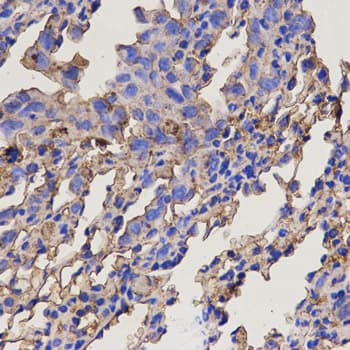 Polyclonal Rabbit anti-Human RAB11A Antibody (IHC, IF, WB)