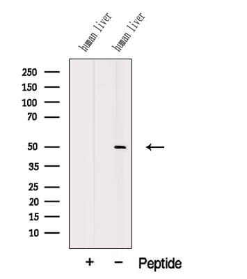 MMP24 Antibody