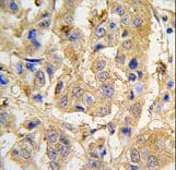 MIPEP Antibody (aa307-336)