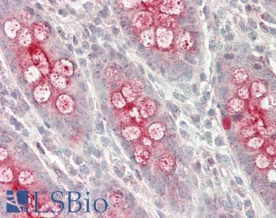 IHC-plus™ MUC13 Antibody (aa480-530)