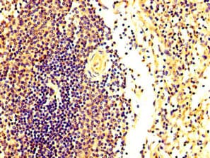 Polyclonal Rabbit anti-Human FASTKD2 Antibody (IHC, WB)