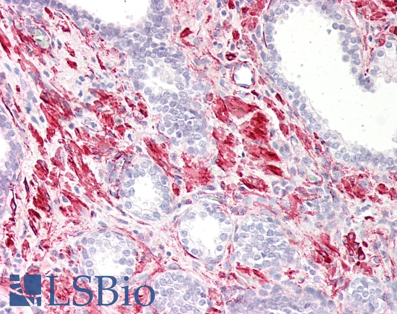 PathPlus™ CALD1 / Caldesmon Antibody