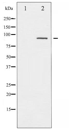 PRKCA / PKC-Alpha Antibody (phospho-Thr638)