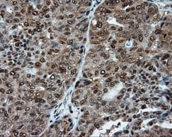 Monoclonal Mouse anti-Human ACLY / ATP Citrate Lyase Antibody (clone 3G8, Carrier-free, IHC, IF, WB)