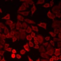 Polyclonal Rabbit anti-Human LECT1 / Chondromodulin-I Antibody (IF, WB)