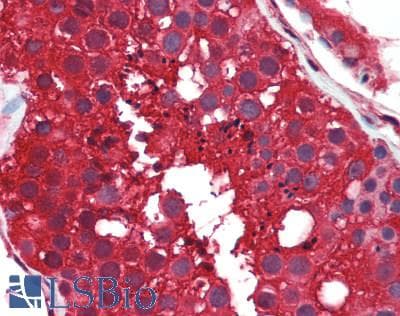 IHC-plus™ PTPMT1 Antibody