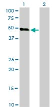 OX2R / Orexin Receptor 2 Antibody (clone 1E3)