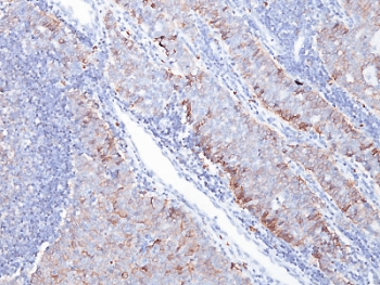 Monoclonal Mouse anti-Human SLC2A1 / GLUT-1 Antibody (clone GLUT1/2476, IHC)