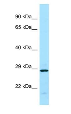 Polyclonal Rabbit anti-Human EIF3J Antibody (C-Terminus, WB)