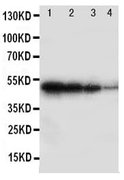 Polyclonal Rabbit anti-Human ALK-6 / BMPR1B Antibody (aa145-160, WB)