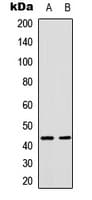 Polyclonal Rabbit anti-Human JUN / c-Jun Antibody (C-Terminus, IHC, WB)