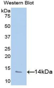 CXCL4 / PF4 Antibody (aa31-101)