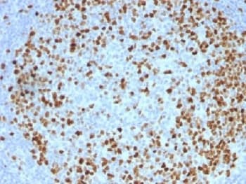 TOP2A / Topoisomerase II Alpha Antibody (clone TOP2A/1362, Azide-free, BSA-free)
