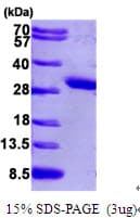Human PCMT1 Protein (Recombinant His)