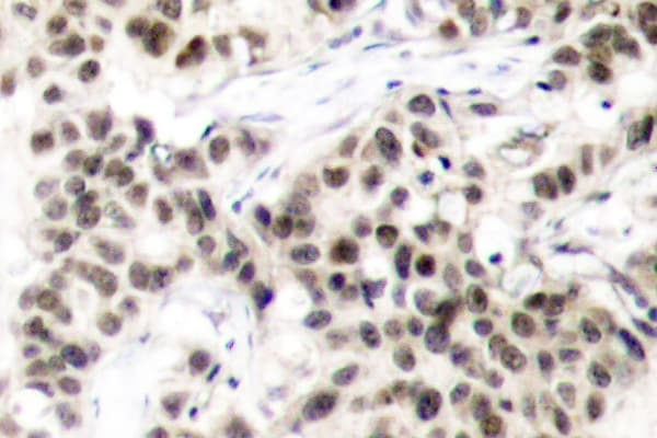 Polyclonal Rabbit anti-Human MYC / c-Myc Antibody (Lys52, IHC, WB)