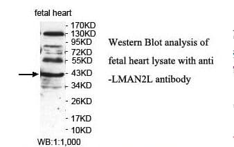 Polyclonal Rabbit anti-Human LMAN2L Antibody (aa164-319, IHC, WB)