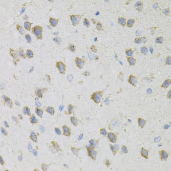 CDA / Cytidine Deaminase Antibody