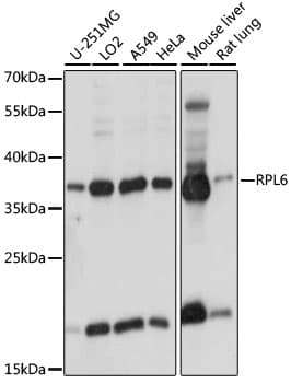 Polyclonal Rabbit anti-Human RPL6 / Ribosomal Protein L6 Antibody (WB)