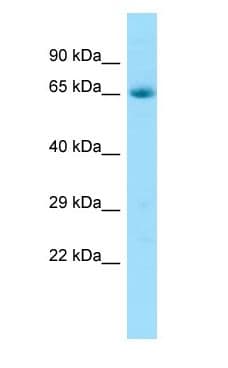 PAEL Receptor / GPR37 Antibody (aa468-517)