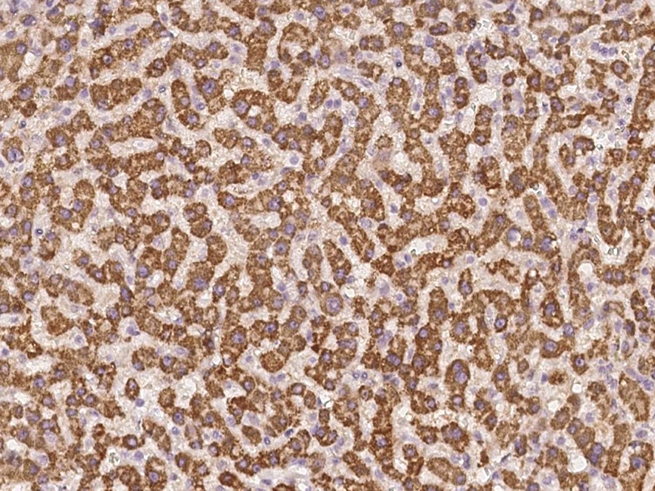 AGXT2 Antibody