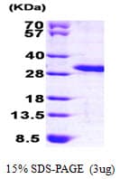 Human MOB4 / PHOCN Protein (Recombinant His)
