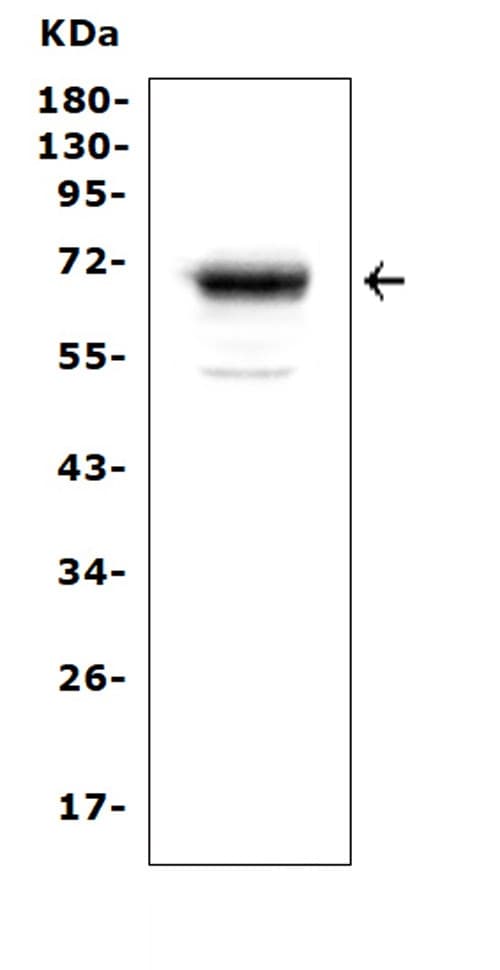 MSLN / Mesothelin Antibody (aa306-576)