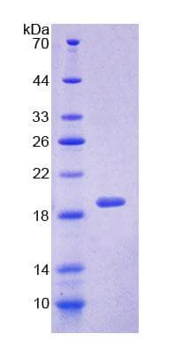 Human SRI / Sorcin Protein (Recombinant His-T7)