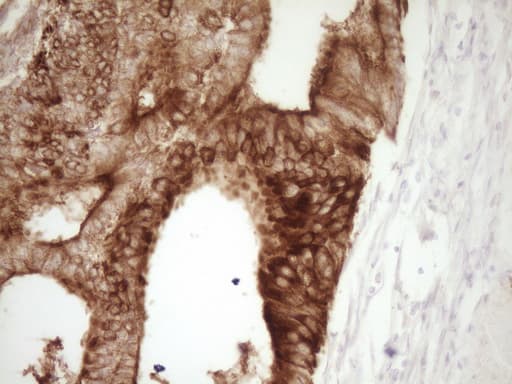 CALCA Antibody (clone 2D10)